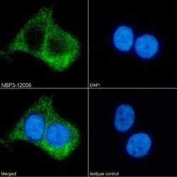 beta-2 Adrenergic R/ADRB2 Rabbit anti-Human, Clone: R11/E1, Novus Biologicals